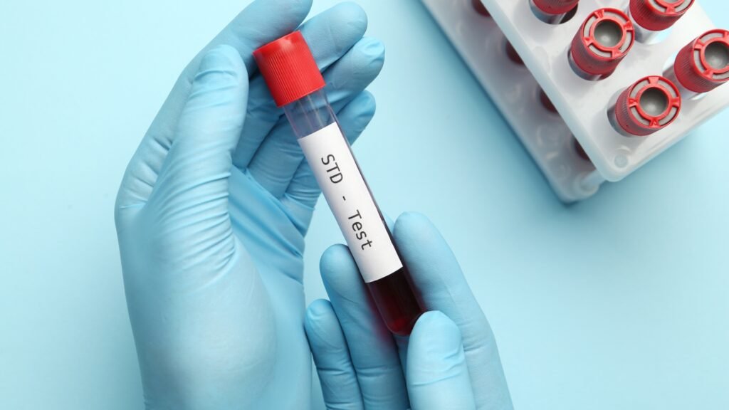 IST, infections sexuellement transmissibles